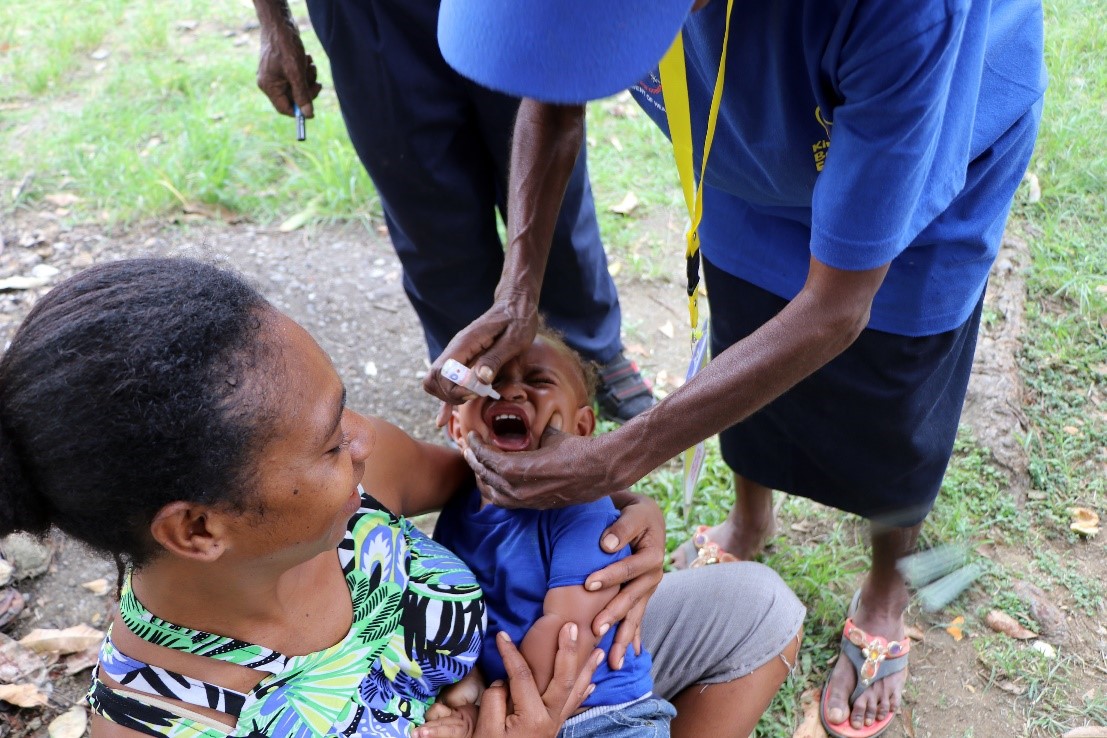 child receiving polio vaccine